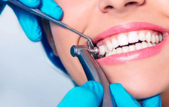 dental-cleaning1