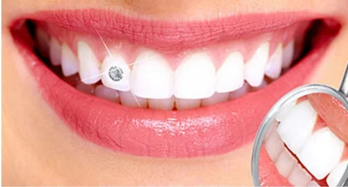 dental-jewellery-500x500
